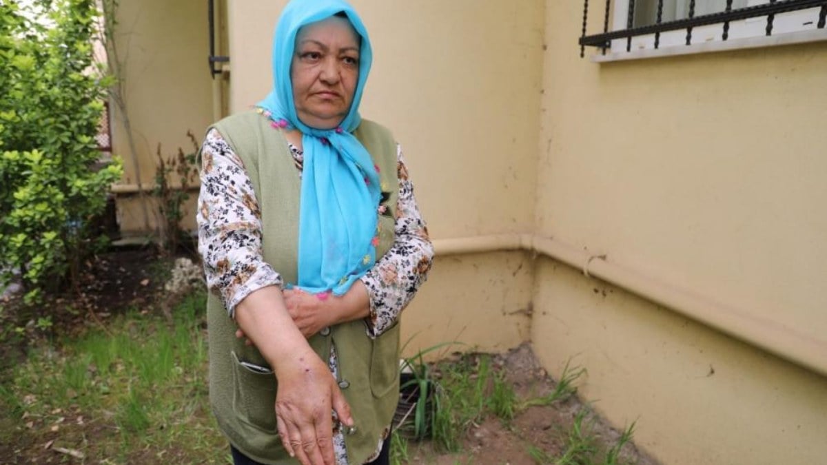 Sakarya’da köpek saldırısına uğrayan kadın o anları gözyaşlarıyla anlattı